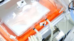 How Single-Use Bioreactor Bags Are Accelerating Modern Biopharmaceutical Production