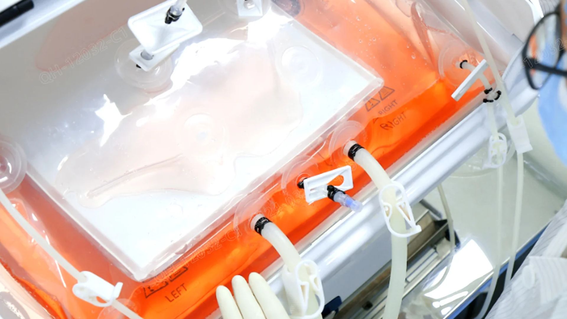 How Single-Use Bioreactor Bags Are Accelerating Modern Biopharmaceutical Production
